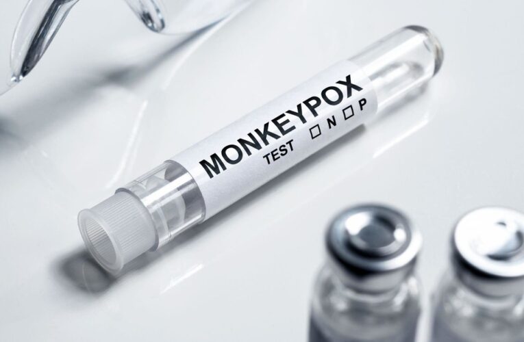 Revelan una posible causa de la rápida propagación de la viruela del mono